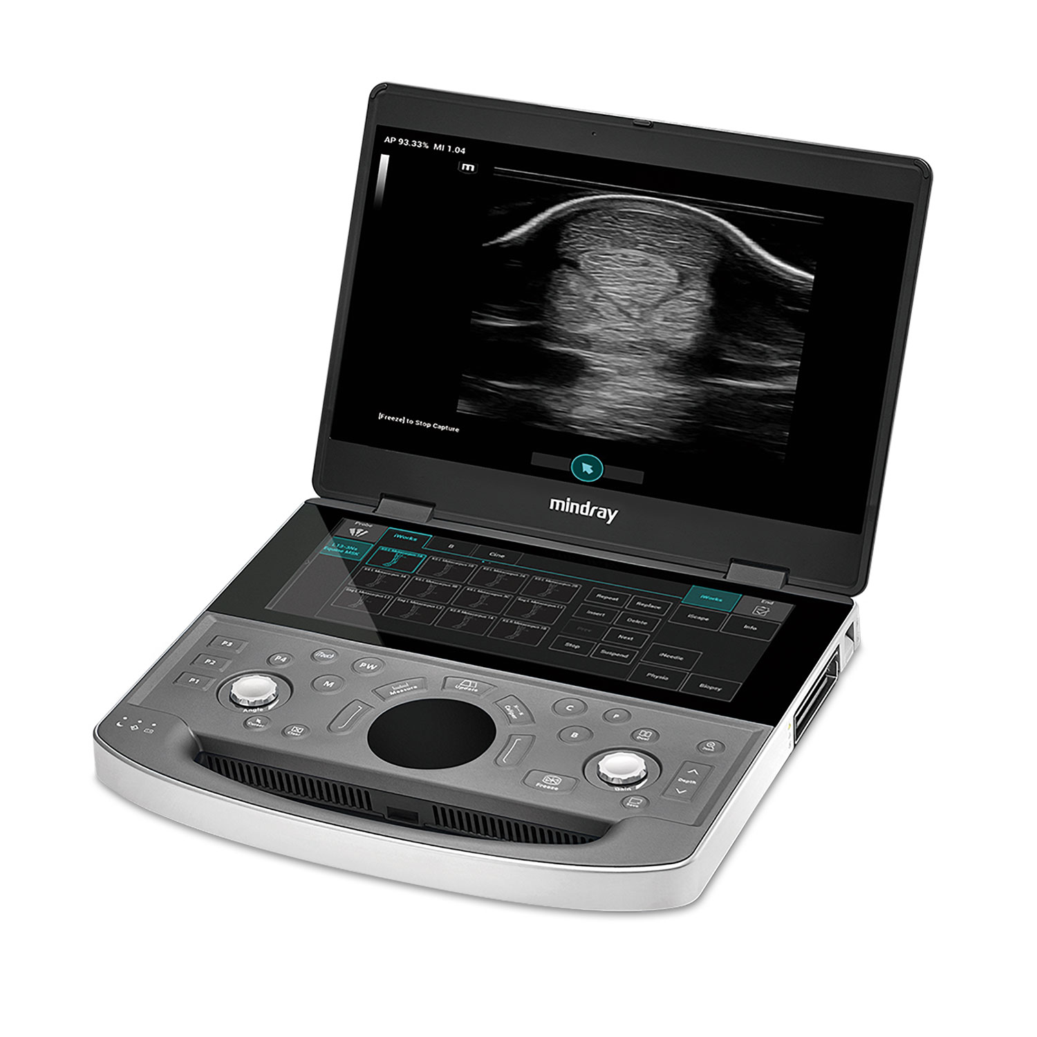 Ultralydsscanner Vetus EQ, inkl. u bank og 2 prober 1